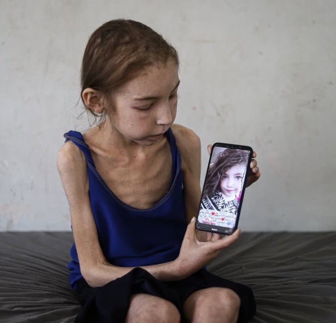 اطفال غزة يموتون جوعا وعطشا في ظل تخاذل عالمي ودولي وعربي سيشهد له التاريخ
لن ينسى التاريخ تخاذلكم ايها المنبطحين
سيخذلكم الله يامن خذلتم غزة..
