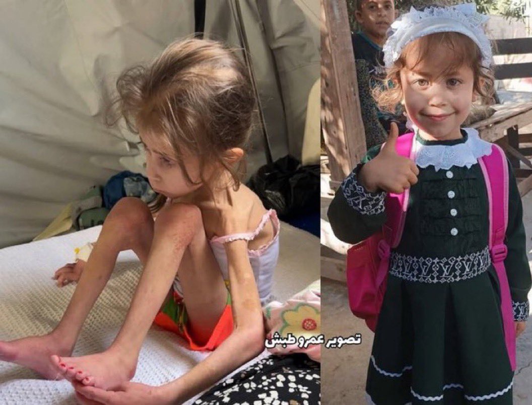 Before &amp; After 🇵🇸💔

حسبنا الله ونعم الوكيل😥
اين العالم من هذه المشاهد
هل فعلآ ماتت الانسانيه
#غزة_تقتل_جوعا 
#غزه_تباد_وتحرق