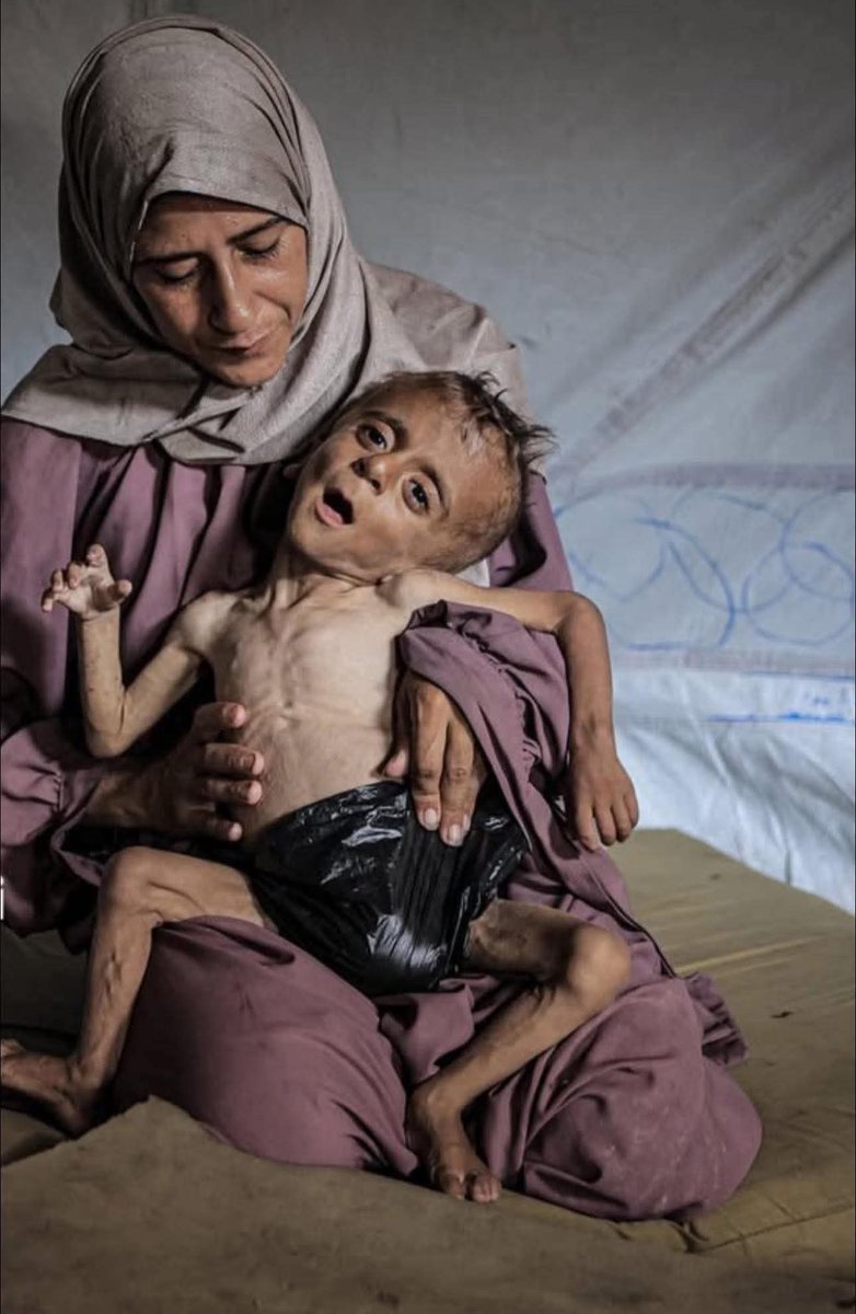 Chief_Walaa's tweet image. PLEASE DON'T SKIP ME :((
🥺
Extremely tired, If u see this post ..
Famine is killing us😥😥
spread it comment 🍉🇵🇸 or even a dot .
Help me, please 🙏🏻
gofund.me/e713f89f