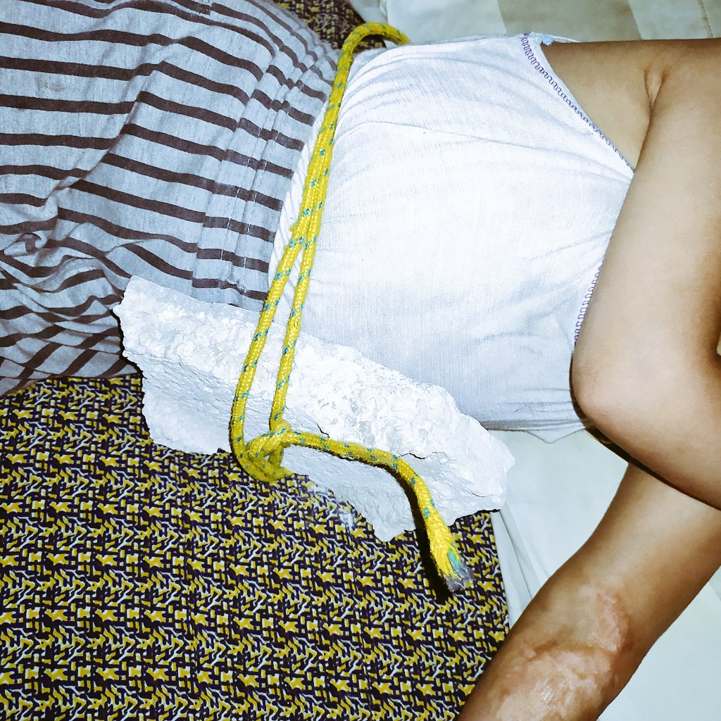 hazemkhilla's tweet image. I tie a stone to my daughterβs stomach so she can sleep and forget the pain of hungerβ¦
What kind of cruelty forces us to use stones instead of food?ππππ»
chuffed.org/project/128377β¦
