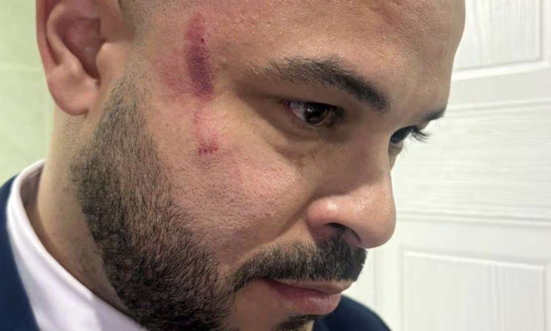 ‘Esto no es político, es personal’. Patio limoso y salseo en la Asamblea Nacional: Bolota pierde el control y amenaza de muerte a Betserai midiario.com/nacionales/est…