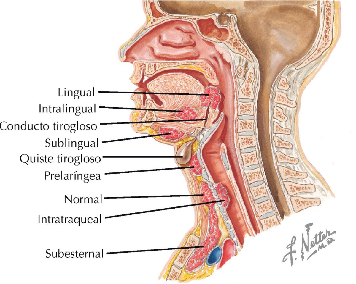 PasionAnatomia's tweet photo. Durante el desarrollo embrionario el #TejidoTiroideo migra desde el suelo de la #faringe hasta el #cuello, guiado por el #ConductoTirogloso, que suele degenerar; sin embargo, en algunos individuos, el tejido tiroideo no migra bien y genera #TejidoTiroideoEctópico. https://t.co/55Twun4s8Z