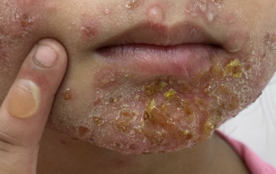 What is the diagnosis ⁉️