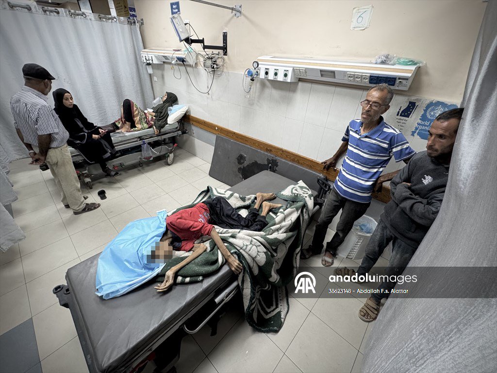 🚨⚡
فلسطینی نوجوان لڑکی رحیل، عمر 32 سال، غزہ میں شدید بھوک کے باعث شہید ہو گئی۔

محاصرے سے پہلے اس کا وزن 50 کلو تھا، اور جب وہ دنیا سے رخصت ہوئی تو اس کا وزن 25 کلو سے بھی کم تھا۔
