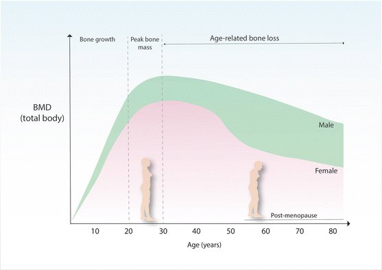 siimland's tweet image. With age your physical health declines:
1. Bone density📉- you need to do weight-bearing exercise
2. Speed📉 - you need to sprint
3. Muscle mass📉- you need to lift and eat enough protein
4. Insulin resistance & dyslipidemia📈- you need to stay physically active and manage food…