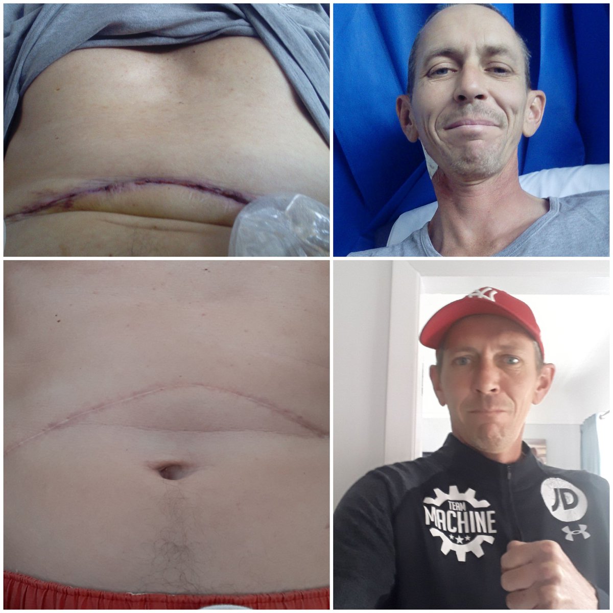 Shaun (๐ทThe Spider๐ท) Walsh ๐๐ (@spiderwalshy) on Twitter photo Let's see what they say <a href="/afowler06/">Anthony Fowler</a> when I describe how much cbd helped me through my pancreatic cancer diagnosis <a href="/supreme_cbd/">Supreme CBD - UKโs #1 CBD OIL</a> ๐๐๐ท๐ Let's see what they say <a href="/afowler06/">Anthony Fowler</a> when I describe how much cbd helped me through my pancreatic cancer diagnosis <a href="/supreme_cbd/">Supreme CBD - UKโs #1 CBD OIL</a> ๐๐๐ท๐
