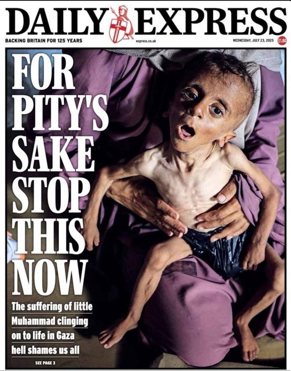 У нас есть такая арабистка и левачка ксения светлова. Без проверки исходника она публикует это фото и к нему хуярит текст:
"На первой странице британского  издания Daily Express -  Мухаммад Закария Аюб Аль-Маатук, ребенок из Газы, который в свои полтора года весит как