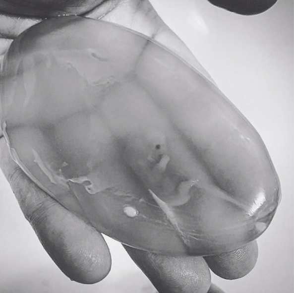 LiveAction's tweet image. Baby Elsie was miscarried at 9 weeks.
Her mother is a photographer and believes, “Every type of birth, every life, deserves to be shared and captured and honored.”
