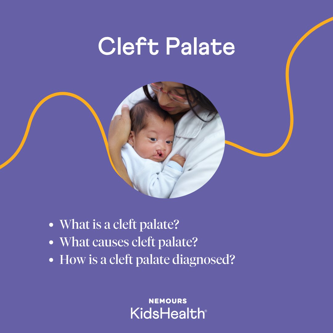 Nemours's tweet image. With a cleft palate, a #baby is born with an opening (a cleft) in the roof of the mouth, which can affect things like eating, breathing, and speaking. Our #experts explain how doctors treat it and how you can support your child every step of the way: bit.ly/44SrApB