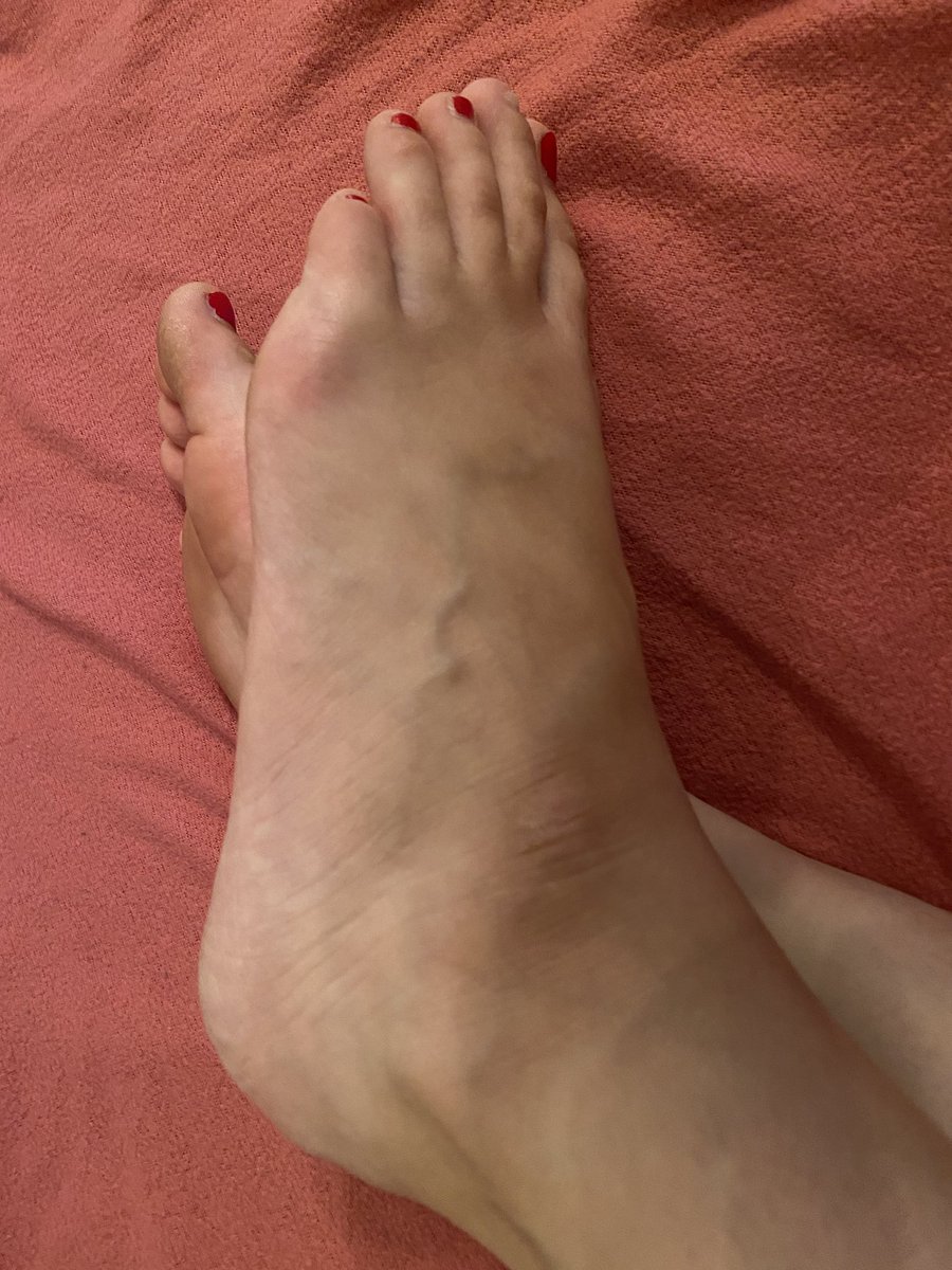 Rose Feet tweet media