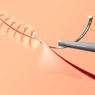 AdelAliBinAli's tweet image. " للتعافي ثمن !
مَن يريد خياطة الجرح،
سيتحمل وخز الإبرة "