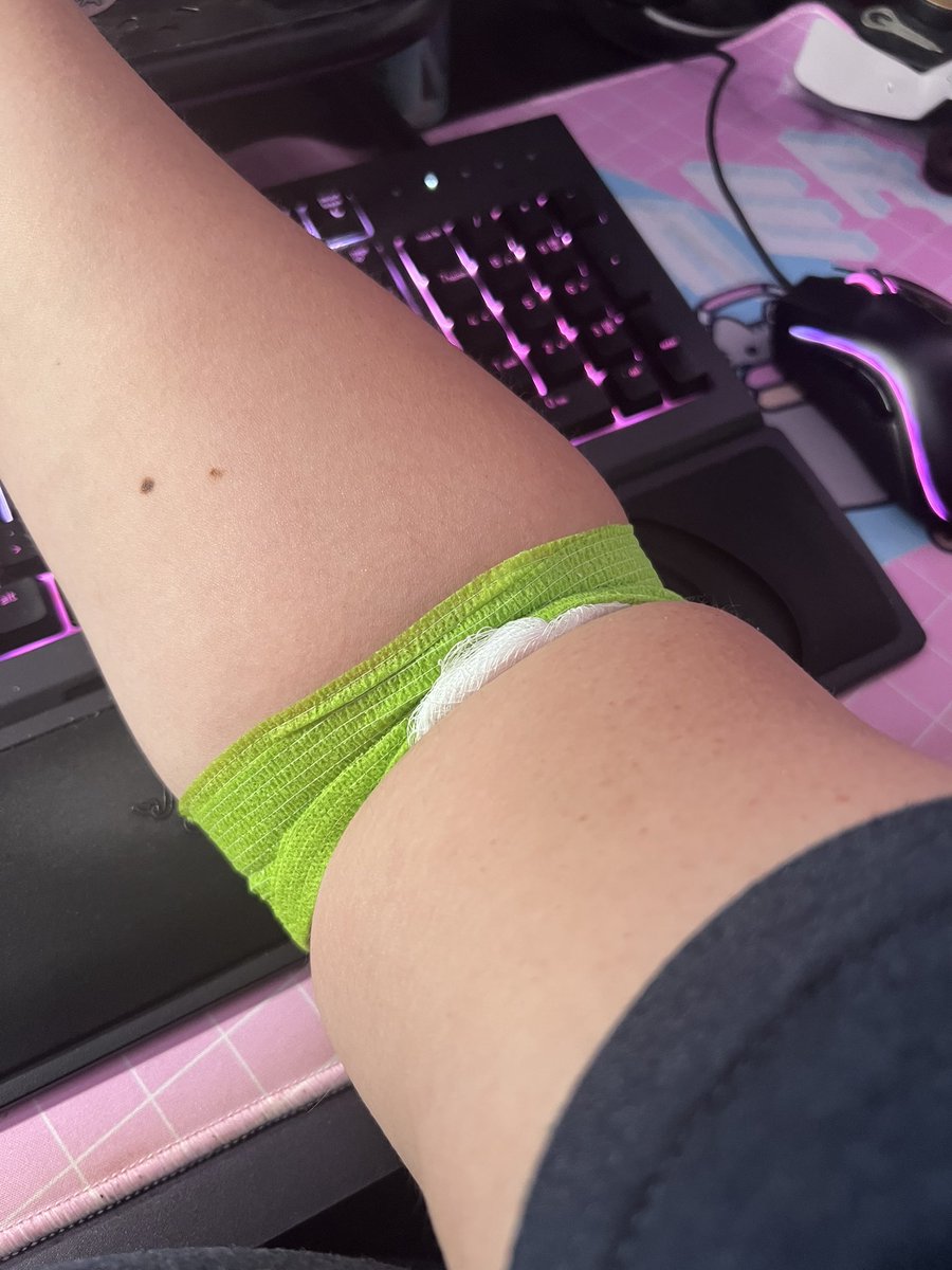 FateJustyne's tweet image. Another day, another blood draw 🩸
Hopefully we got the thyroid meds right this time 🙏