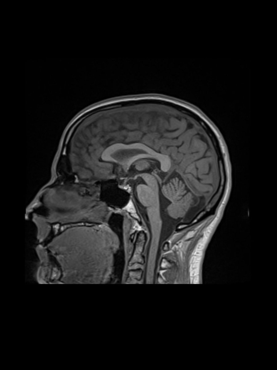 swerdlin's tweet image. I’m gifting 10 @function MRI scans.
Comment “long live @_____” and tag one person you want to live 100 healthy years.
The @function team will randomly select the gift recipients—both those who comment + the person mentioned—after 6 PM on July 25th.
A rush of people have…