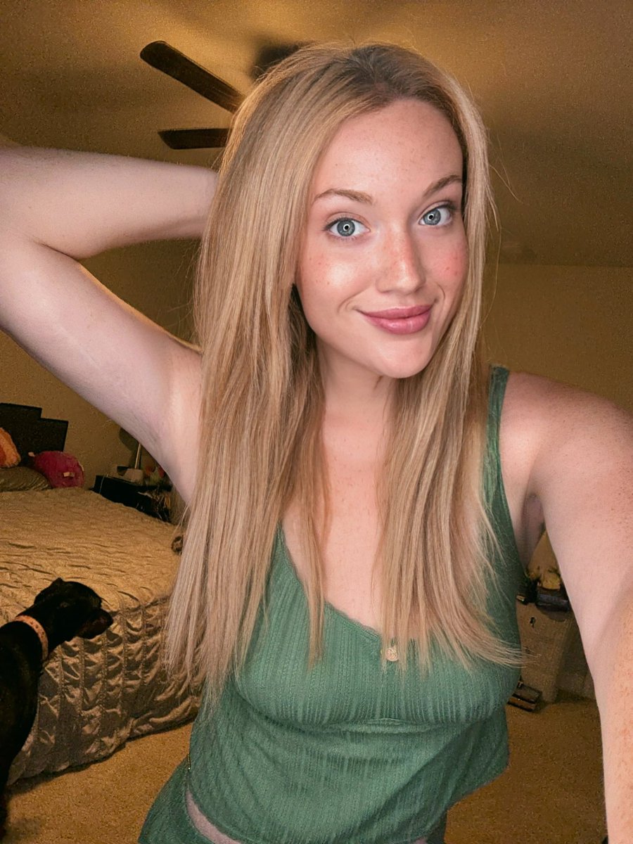 RoamingKam's tweet image. “We never see any of your skin removal scars”
Sorry I don’t typically raise up my arms in photos 🤣 these are my most prominent scars and even these are faint.