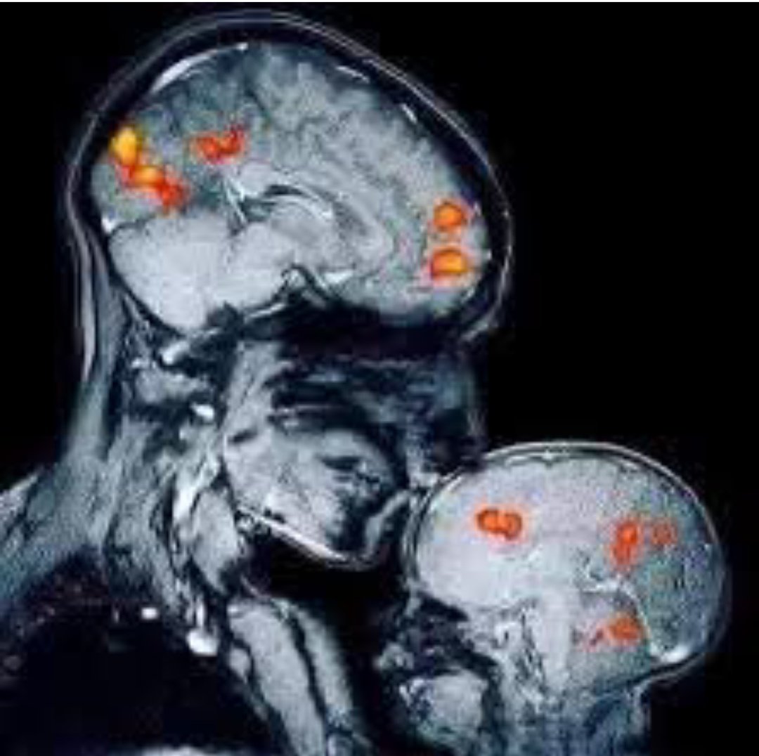 CorreAlexandra's tweet image. Por más #oxitocina y menos #cortisol. Dar amor a un niño, niña y/o adolescente (aunque este último esquive el beso), es beneficioso para la salud mental, espiritual y emocional. Criemos nuevas generaciones humanas: con más paz, empatía y felicidad.