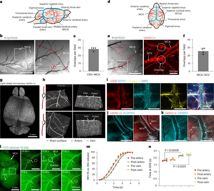 DrImranSheikh's tweet image. A route for cerebrospinal fluid flow through leptomeningeal arterial–venous overlaps enables macromolecule and fluid shunting
nature.com/articles/s4159…