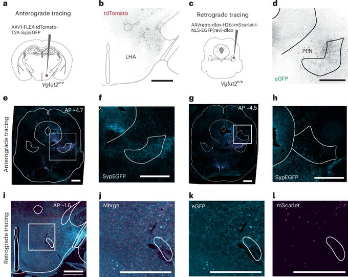 DrImranSheikh's tweet image. A hypothalamus–brainstem circuit governs the prioritization of safety over essential needs
nature.com/articles/s4159…