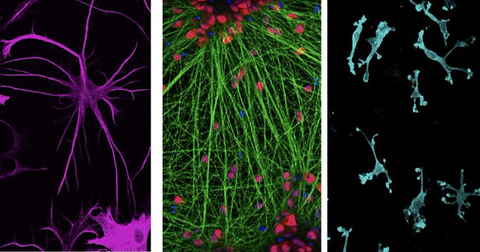 DrImranSheikh's tweet image. Decoding Alzheimer’s
Lish studies how genetic factors impact the progression of Alzheimer’s disease—and provide hints to new treatments
gsas.harvard.edu/news/decoding-…