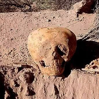 San Fernando del Valle de Catamarca, Argentina. The skull was discovered on May 27, 2025, it belongs to a child estimated to be 3–4 years old at the time of death, with the burial dated to at least 700 years ago.”Oblique artificial cranium deformation”