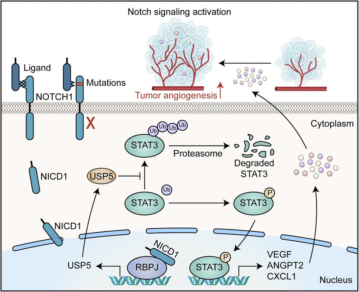 endothelialnews's tweet image. In clinical esophageal squamous-cell carcinoma samples, Notch-signaling activation scores were significantly correlated with tumor microvascular density, advanced TNM stages, and short patient survival time. | @SciReports
馃ゼ Find out more: go.nature.com/40xfyR5