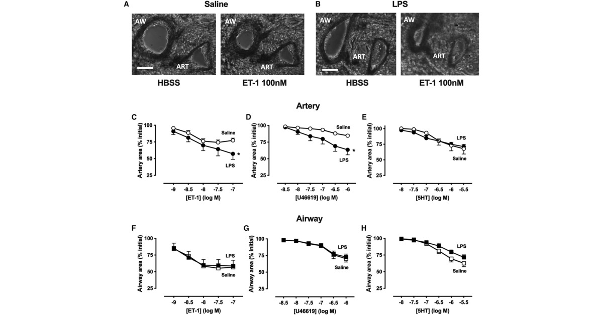 ATS Red Journal (@ajrcmb) on Twitter photo LPS Increases Artery but Not Airway Contraction in Precision-Cut Lung Slices from a Mouse Model of Acute Respiratory Distress Syndrome
<a href="/atscommunity/">American Thoracic Society (ATS)</a>
🔗 tinyurl.com/mr3kr8yw LPS Increases Artery but Not Airway Contraction in Precision-Cut Lung Slices from a Mouse Model of Acute Respiratory Distress Syndrome
<a href="/atscommunity/">American Thoracic Society (ATS)</a>
🔗 tinyurl.com/mr3kr8yw