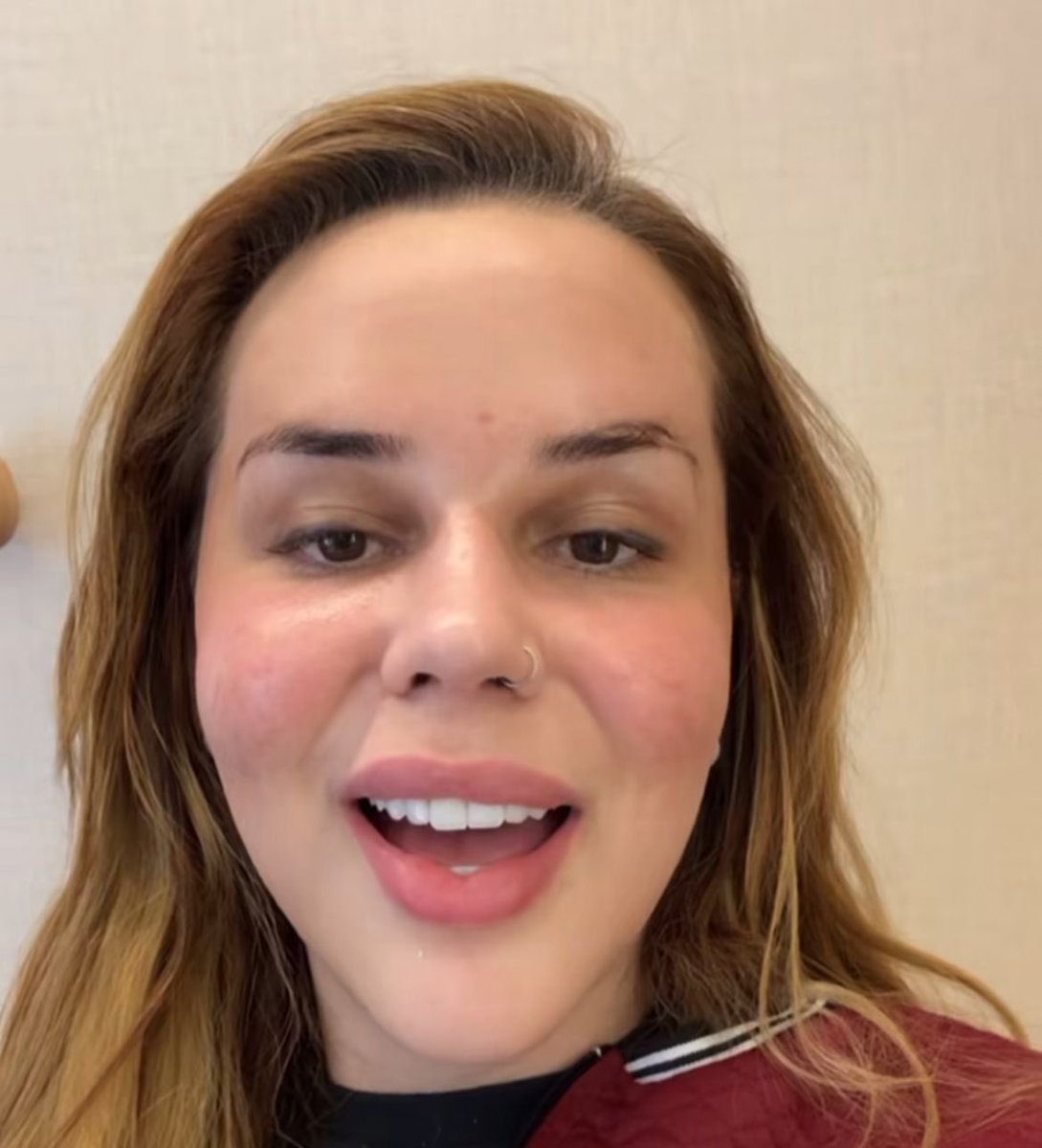QGdoPOP's tweet image. Wanessa Wolf exibe o resultado do procedimento de aplicação de lente nos dentes.