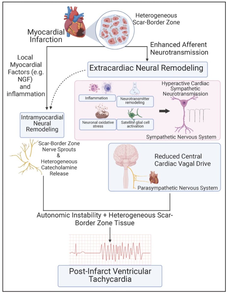 javier20ch's tweet image. Mecanismo de la Taquicardia Ventricular en el Infarto de Miocardio. 🫀⚡️
🔶️El mecanismo de TV postinfarto incluye varios factores en todo el tejido cicatricial miocárdico y una heterogeneidad de repolarización exclusiva de los circuitos de TV.
🔶️La remodelación nerviosa…