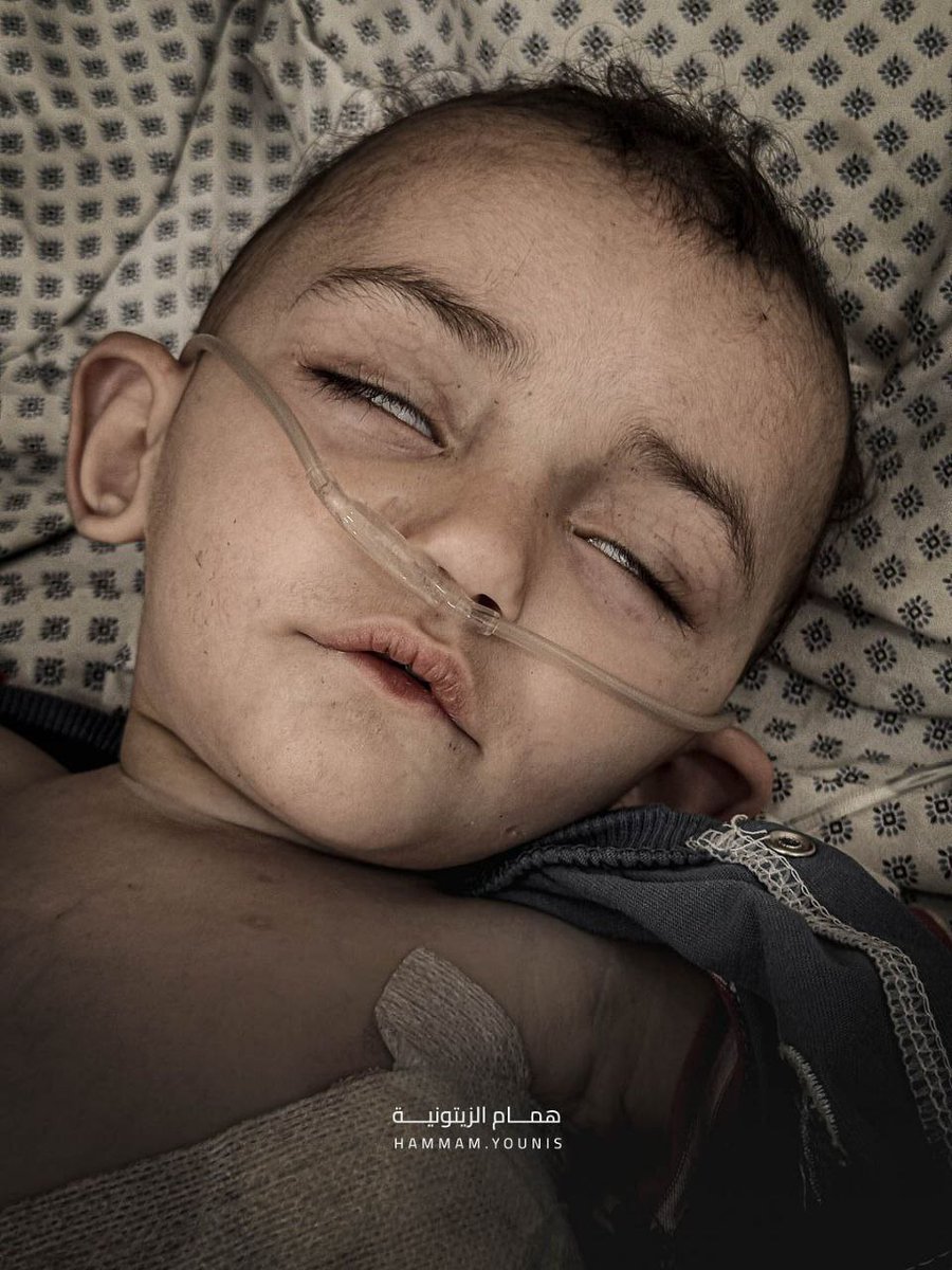 Palest_Children's tweet photo. The Children of #Gaza are Dying from Starvation 

#PalestinianChildrenRights
#SahabatPalestina_ID https://t.co/36U6vLAplv