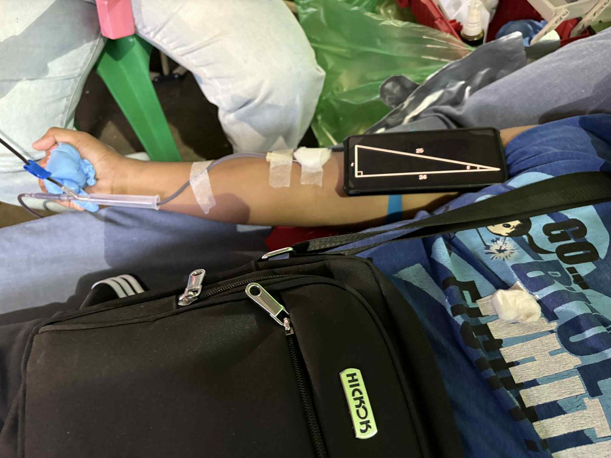 ZahlenRMD's tweet image. Blood Letting Activity
Date: 7-24-25 (Pythagorean Triple)
Q: What is the ratio of the radius of the inscribed circle and the circumscribed circle of the triangle with sides 7-24-25?
#sharingisthenewlearning