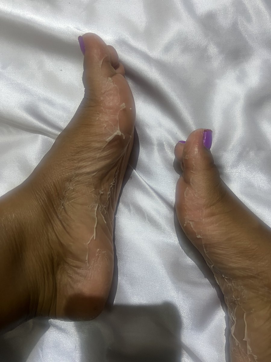 ConfessToVex's tweet photo. Caught mid-shed.
Want to see what’s under the peel?
Empty your pockets and let Me strip more than just My skin.  

💸 $ConfessToVex

#Findom #Paypig #FootPeel #FeetPics #GoddessVibes #FootFetish #femdomism https://t.co/B6ZlkdKyJ4