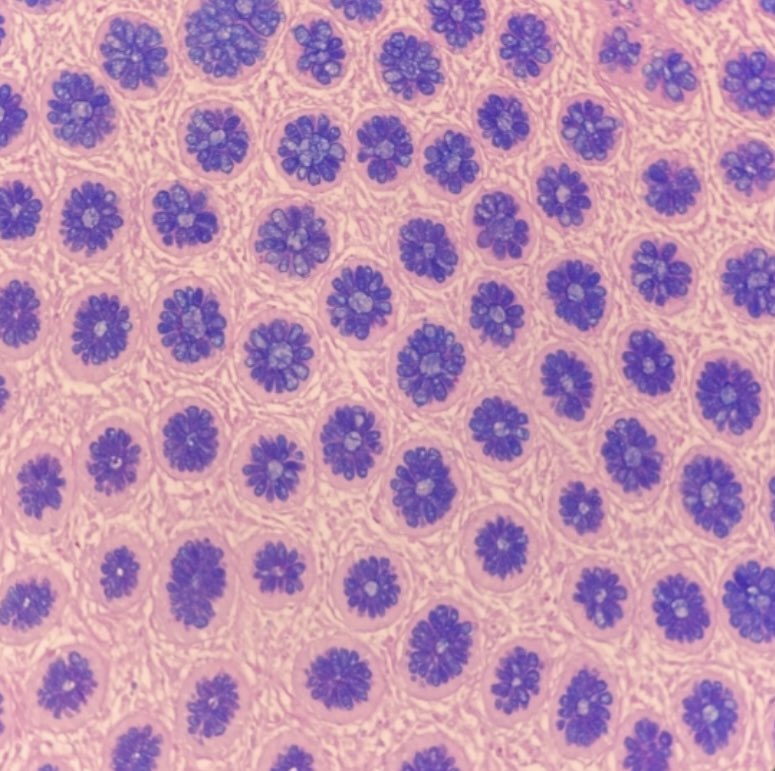 Sometimes pathology is pure art. Alcian Blue 
#pathology #pathtwitter