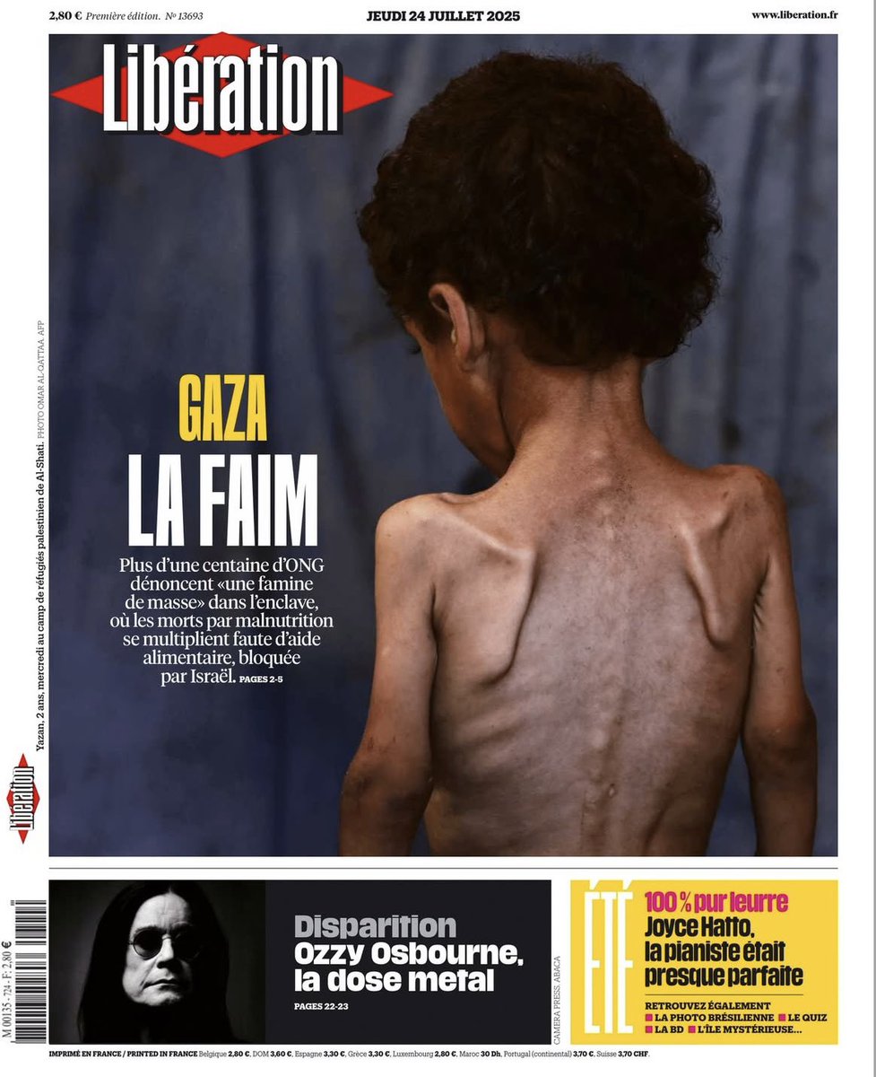 Karima Delli (@karimadelli) on Twitter photo Gaza : la faim <a href="/libe/">Libération</a>
Plus d'une centaine d'ONG dénoncent «une famine de masse» dans l'enclave, où les morts par malnutrition se multiplient faute d'aide alimentaire, bloquée par Israël.
Photo: Yazan, 2 ans, au camp de réfugiés palestinien de Al-Shati
📸 Omar Al-Qattaa/AFP
#Gaza Gaza : la faim <a href="/libe/">Libération</a>
Plus d'une centaine d'ONG dénoncent «une famine de masse» dans l'enclave, où les morts par malnutrition se multiplient faute d'aide alimentaire, bloquée par Israël.
Photo: Yazan, 2 ans, au camp de réfugiés palestinien de Al-Shati
📸 Omar Al-Qattaa/AFP
#Gaza