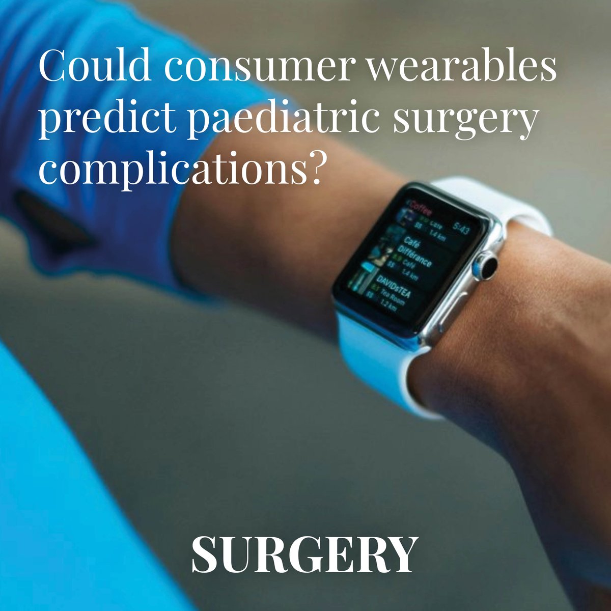 Could consumer wearables predict paediatric surgery complications?
This is according to a study published in Science Advances, 
devices could be used to predict complications for paediatric patients accurately.