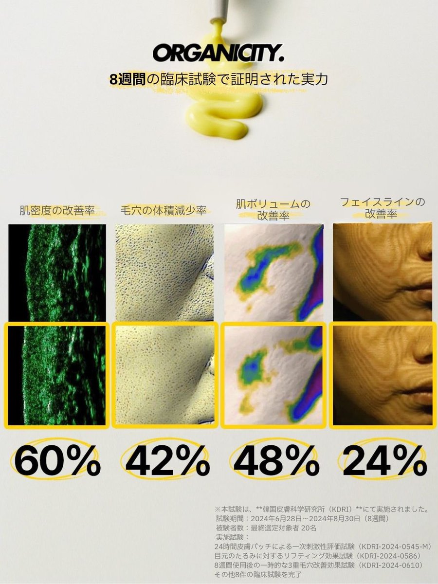 Organicity_jp's tweet image. オーガニシティ 𝙉.𝙊.𝙑.𝘼. 𝙍𝙭ライン、初公開。
𝙀𝙭-𝙍𝙚𝙩𝙞𝙣𝙤𝙡™ 𝘽𝘼𝙆𝙐𝘾𝙃𝙄𝙊𝙇 15% 配合🧪💛

低刺激テストを含む全11種の臨床試験 × 8週間の使用実証
高濃度 × 低刺激 ― 次世代型レチノール、誕生。

時間の流れとともに、
少しずつ変わりはじめた自分に気づいたとき。…