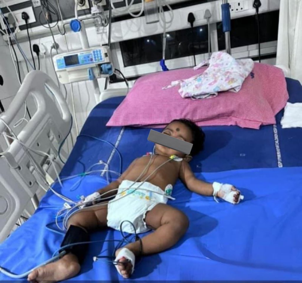 avinash_lalala's tweet image. Hi guys,

My friend‘s niece is suffering from liver infection and she is now admitted in KIMS. Treatment cost is estimated around 20L - 30L. Please  donate, doesn’t matter the amount every rupee counts 🙏🏻

RT for visibility

@suspiciyash