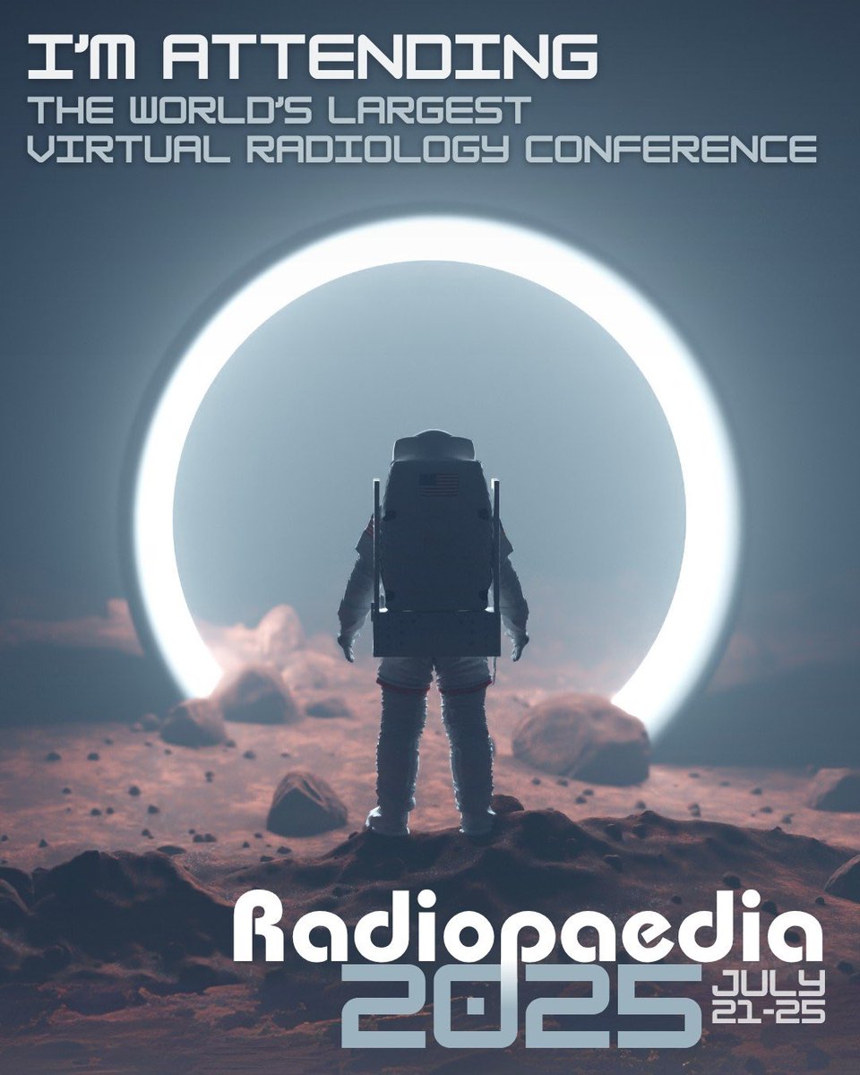 maw (@totoro8889) on Twitter photo I am attending the world’s largest virtual radiology conference.
Thanks <a href="/Radiopaedia/">Radiopaedia.org</a> team from the bottom of my heart because I can join from Myanmar with a free access pass .
#Radiopaedia2025 I am attending the world’s largest virtual radiology conference.
Thanks <a href="/Radiopaedia/">Radiopaedia.org</a> team from the bottom of my heart because I can join from Myanmar with a free access pass .
#Radiopaedia2025