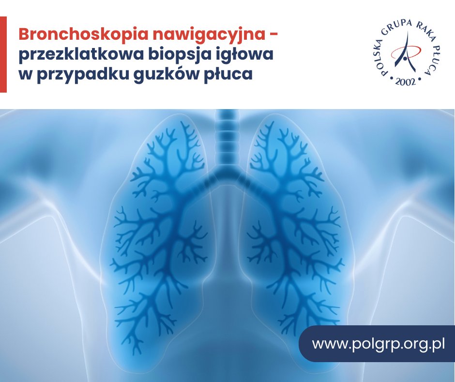 🔎 W wyniku otwartego, wieloośrodkowego, z równoległymi grupami badania VERITAS z randomizacją, diagnostyczna dokładność bronchoskopii nawigacyjnej okazała się nie gorsza od transtorakalnej biopsji igłowej wykonanych u chorych z guzami o wymiarach 10-30mm położonymi obwodowo.
