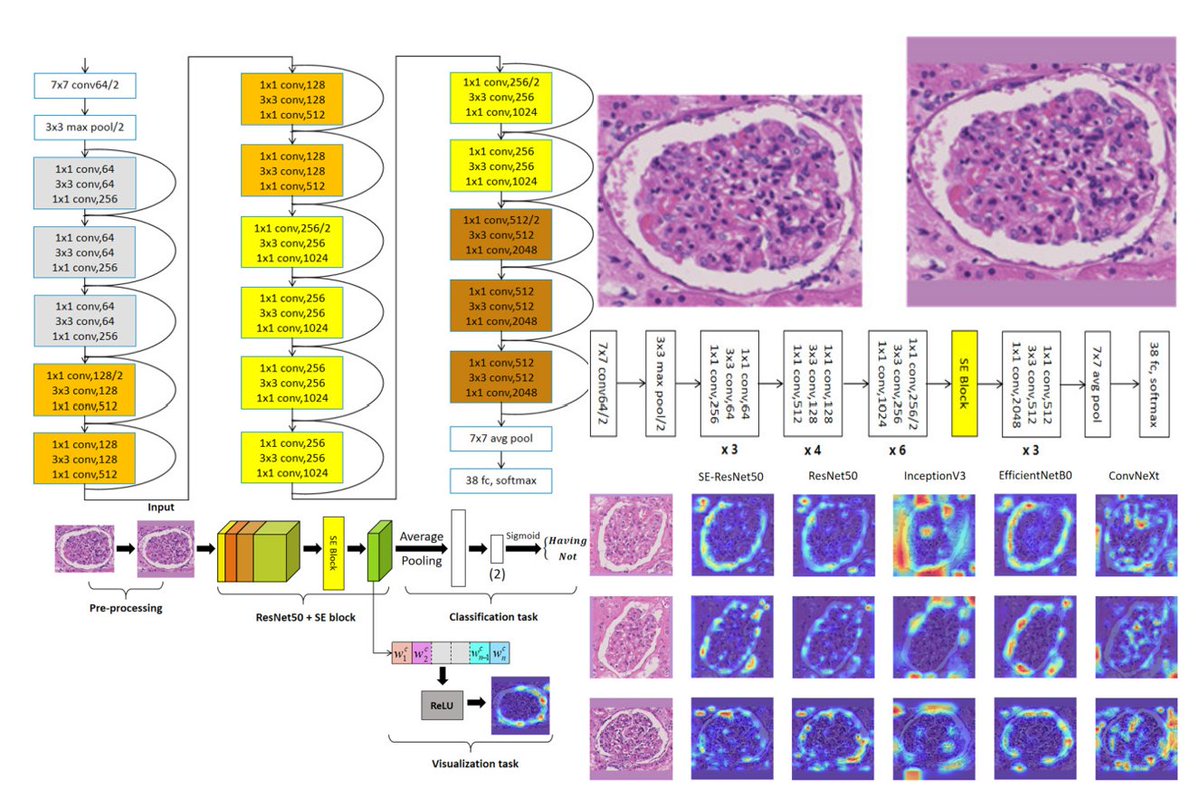 medntdj's tweet image. Image analysis of diabetes pathology: classifying with precision via an upgraded resnet50 framework
sciencedirect.com/science/articl…
#MedTwitter #scicomm #MedEd #AcademicTwitter #Glomerular