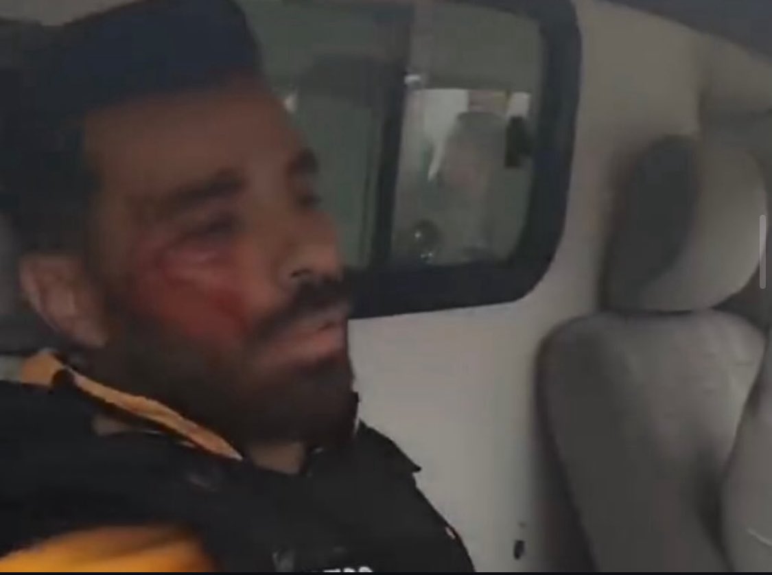 thaer_aabed_'s tweet image. Fellow journalist Talal Al-Orouqi, a direct Al Jazeera reporter, was injured in an Israeli bombing in Nuseirat in the central Gaza Strip.