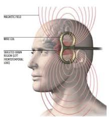 La neuromodulation dans le #TDAH? 
Utiliser des ondes électromagnétique ou un courant indolore pour diminuer les symptômes.
Une méta-analyse dit oui!
sciencedirect.com/science/articl…