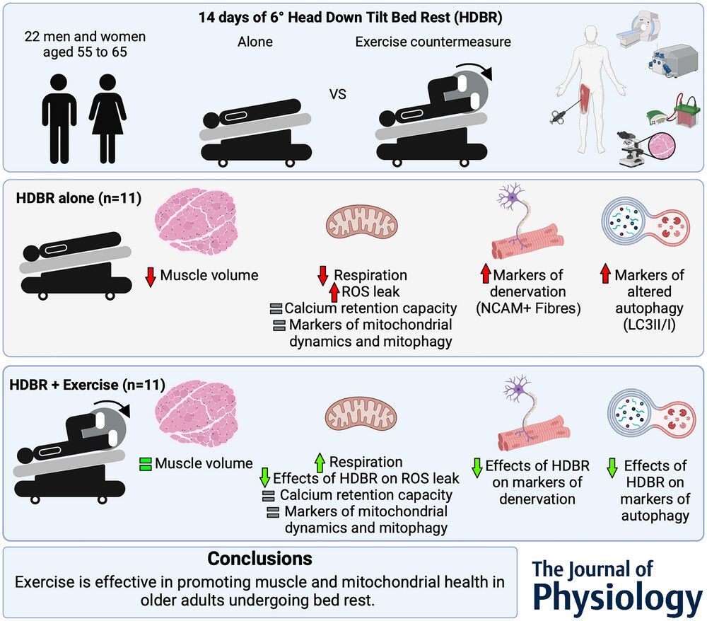 Journal of Physiology (@jphysiol) on Twitter photo Recent #Research by Maude Dulac (<a href="/McGillMed/">McGill Medicine and Health Sciences</a>) et al. finds that a #multimodal exercise countermeasure prevents the negative impact of head-down tilt #bedrest on muscle volume and mitochondrial health in older adults 🛌 🔎
📜 Read the article here: buff.ly/mtmUFpe Recent #Research by Maude Dulac (<a href="/McGillMed/">McGill Medicine and Health Sciences</a>) et al. finds that a #multimodal exercise countermeasure prevents the negative impact of head-down tilt #bedrest on muscle volume and mitochondrial health in older adults 🛌 🔎
📜 Read the article here: buff.ly/mtmUFpe