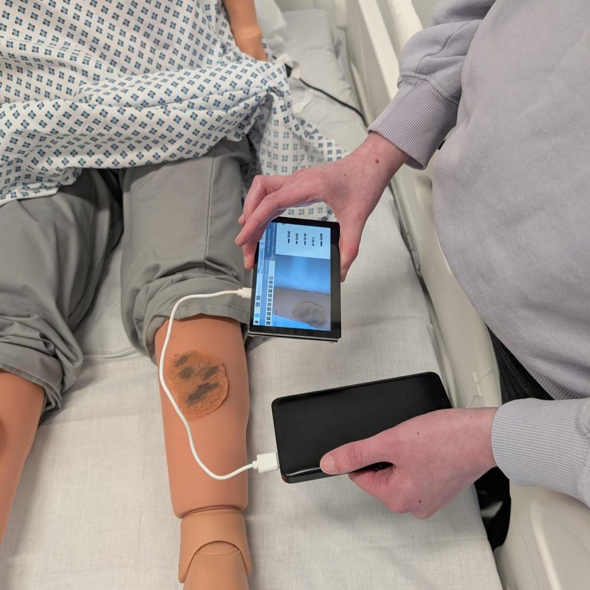 PhD researcher Tess Watt is using AI + Raspberry Pi tech to diagnose skin cancer offline, empowering patients in remote areas to get faster, life-saving diagnoses.

More here: bit.ly/450qXKx
 
#HeriotWattUni