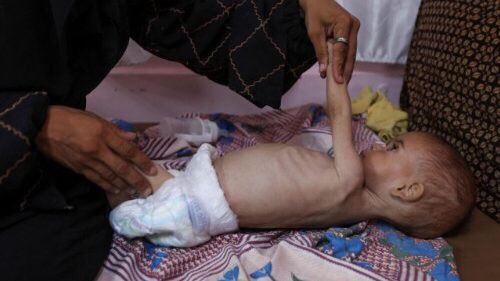 Martina Pastorelli (@cathvoicesita) on Twitter photo “A #Gaza non entrano cibo, farmaci, elettricità da mesi, queste necessità vitali sono bloccate a pochi chilometri da chi ne ha bisogno e questo è disumano.”
Il Vicario di <a href="/custodiaTS/">Custodia Terrae Sanctae</a> denuncia “lo scandalo e la vergogna di un mondo che ha messo al primo posto gli interessi “A #Gaza non entrano cibo, farmaci, elettricità da mesi, queste necessità vitali sono bloccate a pochi chilometri da chi ne ha bisogno e questo è disumano.”
Il Vicario di <a href="/custodiaTS/">Custodia Terrae Sanctae</a> denuncia “lo scandalo e la vergogna di un mondo che ha messo al primo posto gli interessi