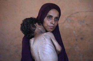 InfoEquitable (@infoequitable) on Twitter photo En Une de <a href="/libe/">Libération</a>, « Gaza La Faim » avec un enfant squelettique.
– son père va bien. Ses frères vont bien (x.com/eyeonpalestine…)
- sa mère va bien (x.com/naba_pix/statu…)
Quant au photographe Omar Al-Qattaa de l’<a href="/AFP/">AFP News Agency</a> qui a pris la photo, il est connu pour son soutien au En Une de <a href="/libe/">Libération</a>, « Gaza La Faim » avec un enfant squelettique.
– son père va bien. Ses frères vont bien (x.com/eyeonpalestine…)
- sa mère va bien (x.com/naba_pix/statu…)
Quant au photographe Omar Al-Qattaa de l’<a href="/AFP/">AFP News Agency</a> qui a pris la photo, il est connu pour son soutien au