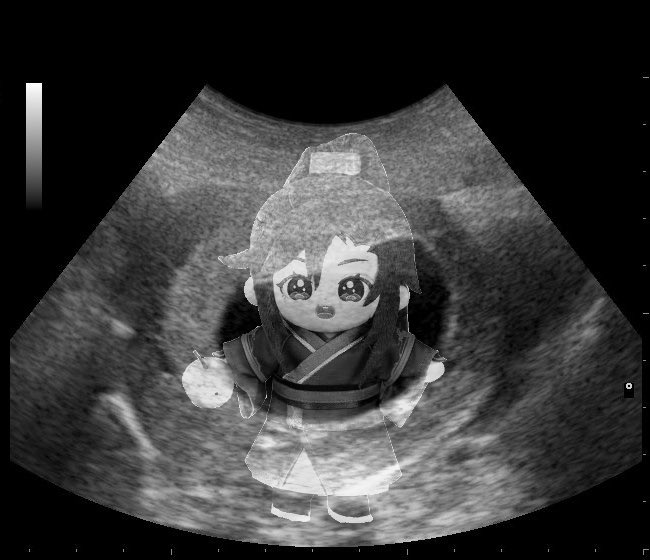 _calamiity's tweet image. im pregnant