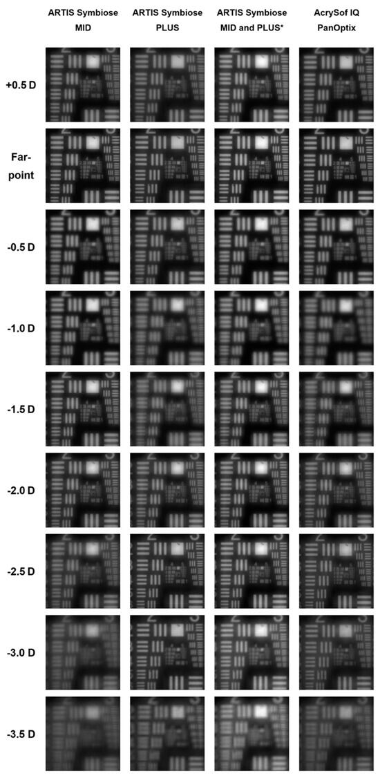 JCM_MDPI's tweet image. #mdpijcm
Enjoy new #Feature_Paper
Review of Mix-and-Match Approach and Binocular ##Intraocular_Lens Systems
🎯mdpi.com/3359202
by Tadas Naujokaitis et al. 
Views 480 @MediPharma_MDPI