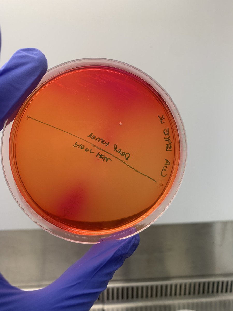 SciencesNCL's tweet image. 🧪 Lab life week 3! With my amazing PhD mentor Lee, we filtered, plated, and streaked bacteria to hunt for E. coli, Salmonella &amp;amp; Pseudomonas. DNA’s extracted &amp;amp; ready for sequencing next week—our ecosystem’s molecular profile is coming together! 🌱#womeninSTEM @RoyalMicroSoc