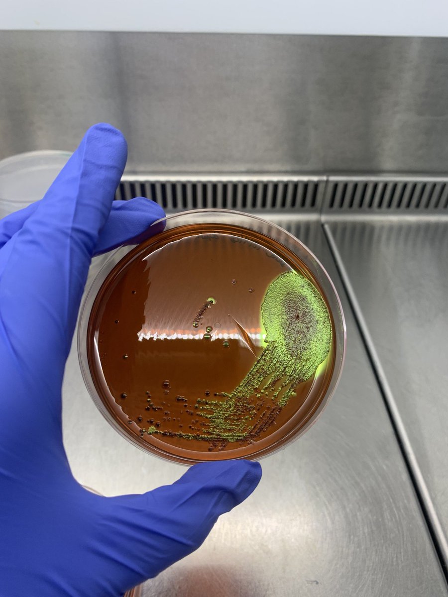 SciencesNCL's tweet image. 🧪 Lab life week 3! With my amazing PhD mentor Lee, we filtered, plated, and streaked bacteria to hunt for E. coli, Salmonella &amp;amp; Pseudomonas. DNA’s extracted &amp;amp; ready for sequencing next week—our ecosystem’s molecular profile is coming together! 🌱#womeninSTEM @RoyalMicroSoc