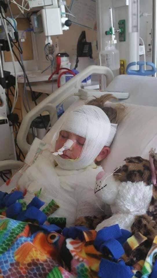 catsscareme2021's tweet image. Imagine your childs skin starts bubbling off and they almost go blind post vaccination-  but you&apos;re a Nurse and will continue to vaccinate. My God. 

&quot;Thanks everyone! She was a trooper! It was very hard to watch her under all the anasthesia, getting fed through a tube her…