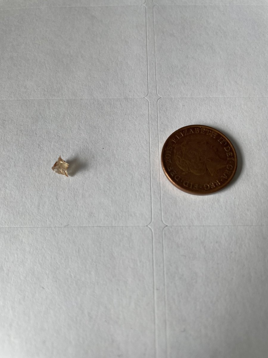 Asda’s CS don’t seem overly fussed that mum nearly swallowed this bit of glass that was in her choc, last night. A refund &amp; £3 good will gesture. Then £10. No concern that it might be a contaminated batch &amp; there may be more. I’m so surprised they don’t seem to give a s**t <a href="/asda/">Asda</a>